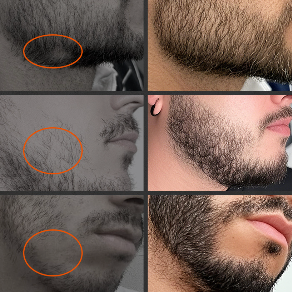 Beard Growth Oil *2; Dual Teeth Beard Comb; Beard Balm; Microneedle Roller; Buggy Bag