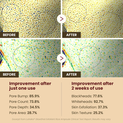 Luhaka® GlowShot Exfoliant Rice Ampoule