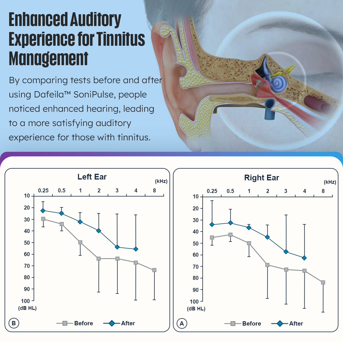 🔥Dafeila™ SoniPulse Tinnitus Relief Soothing Aid
