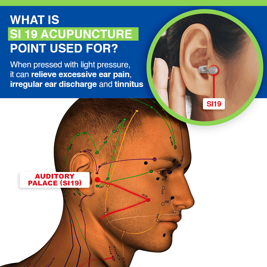 LUHAKA™ - AcuPeace Tinnitus Relief Device